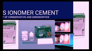 Glass Ionomer Cement GIC [upl. by Cindra670]