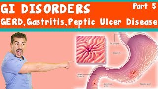 GI Disorders GERD Gastritis peptic ulcer Disease Part 5 [upl. by Tannenwald]