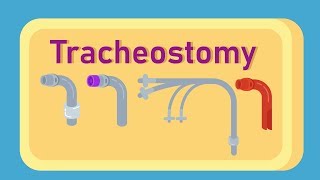 What is Tracheostomy [upl. by Accalia]