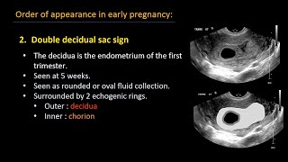 Ultrasound of normal early pregnancy [upl. by Aneeles972]